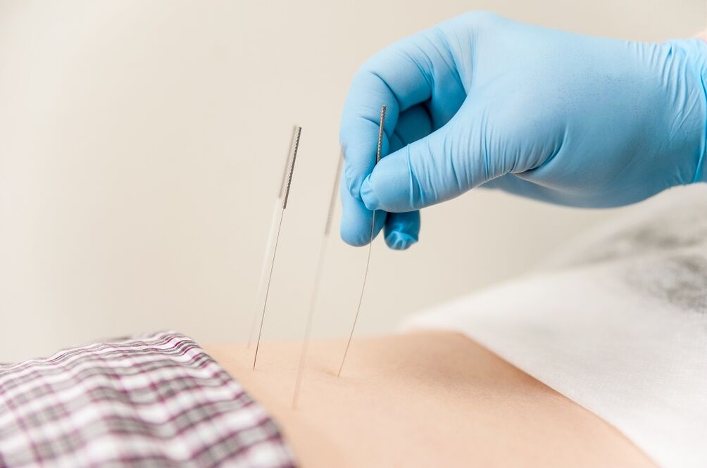 Behandeling van thoracale osteochondrose