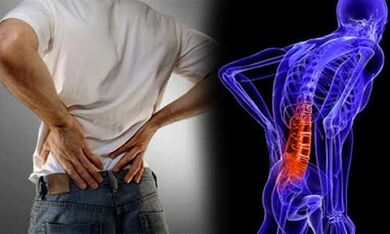 De redenen voor de ontwikkeling van lumbale osteochondrose