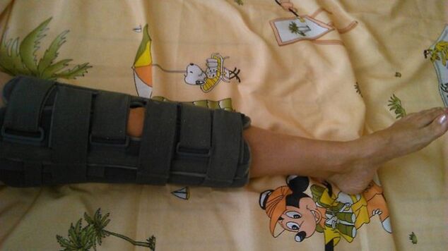 immobilisatie van het kniegewricht voor pijn